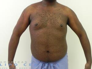 americanlipocenters_195.jpg